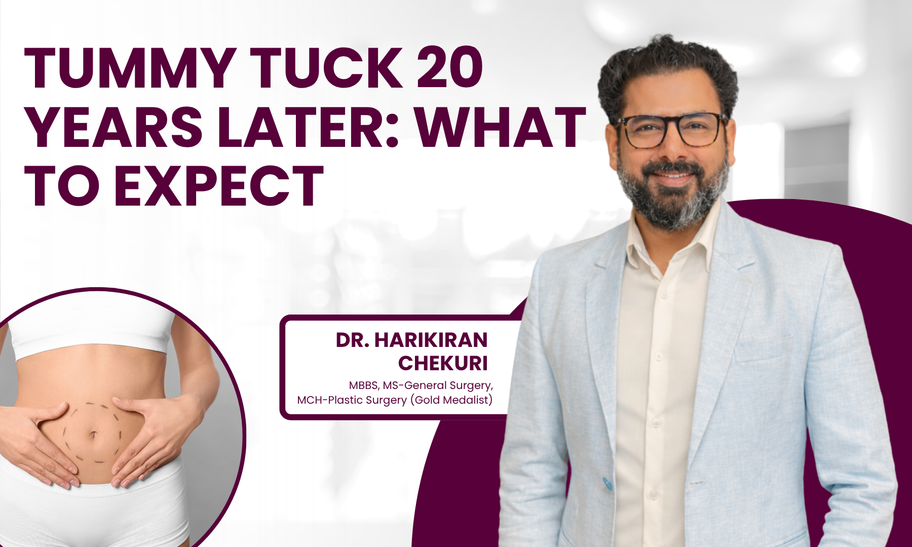 Tummy Tuck 20 Years Later What to Expect
