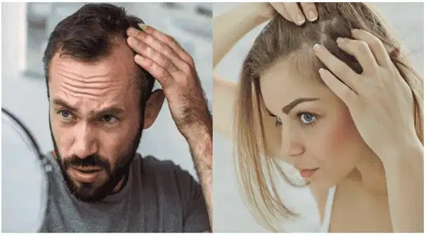 Hair Loss