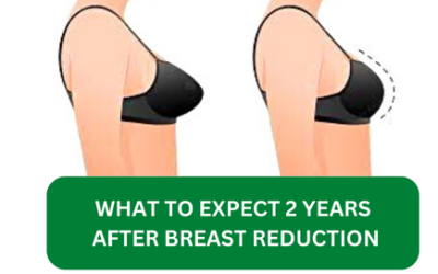 What to Expect 2 Years After Breast Reduction