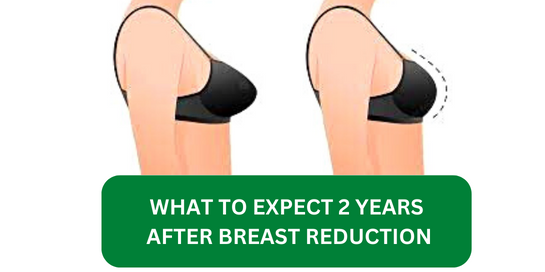 What to Expect 2 Years After Breast Reduction