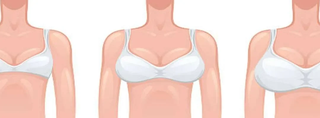 Heavy Breasts – A Boon Or A Bane?