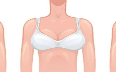 Heavy Breasts – A Boon Or A Bane?