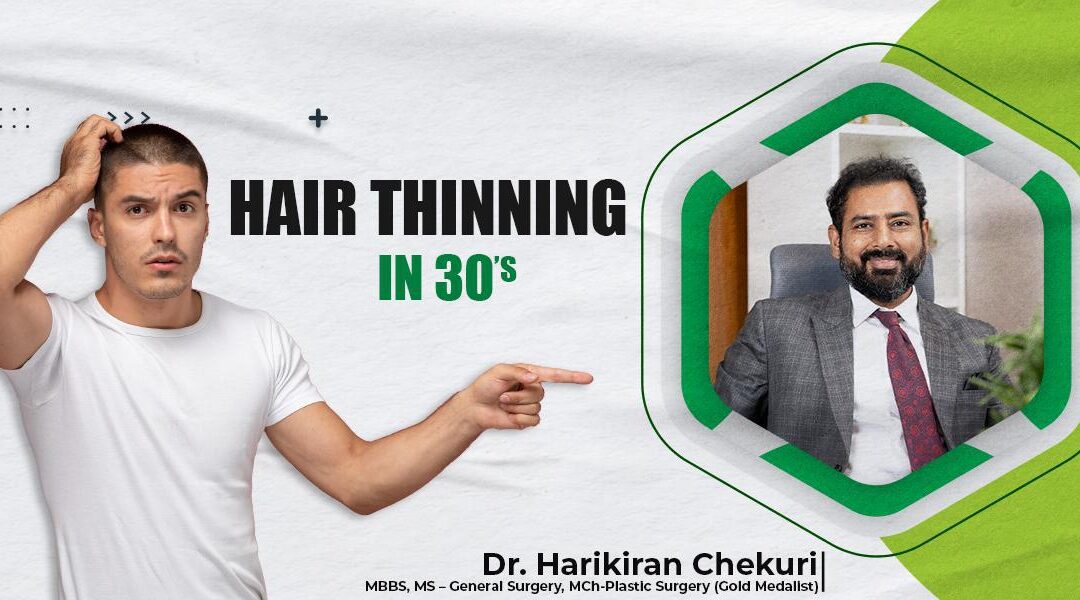 Understanding Hair Thinning in 30s: Insights & Solutions