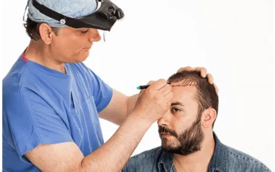 Is hairline design important for a hair transplant?