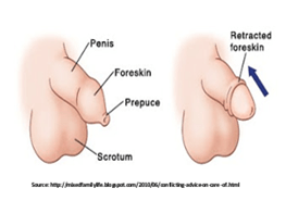 Circumcision Surgery