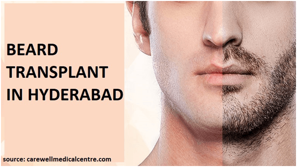 Beard Transplant in Hyderabad