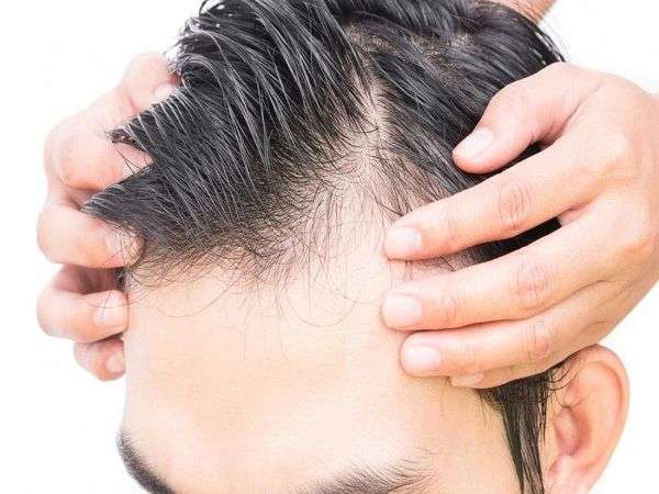 Hair PRP Treatment