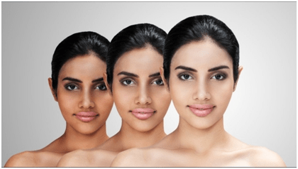 skin-whitening