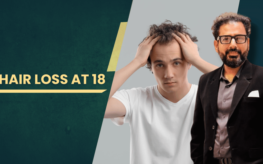 Hair Loss at 18
