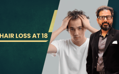 Hair Loss at 18
