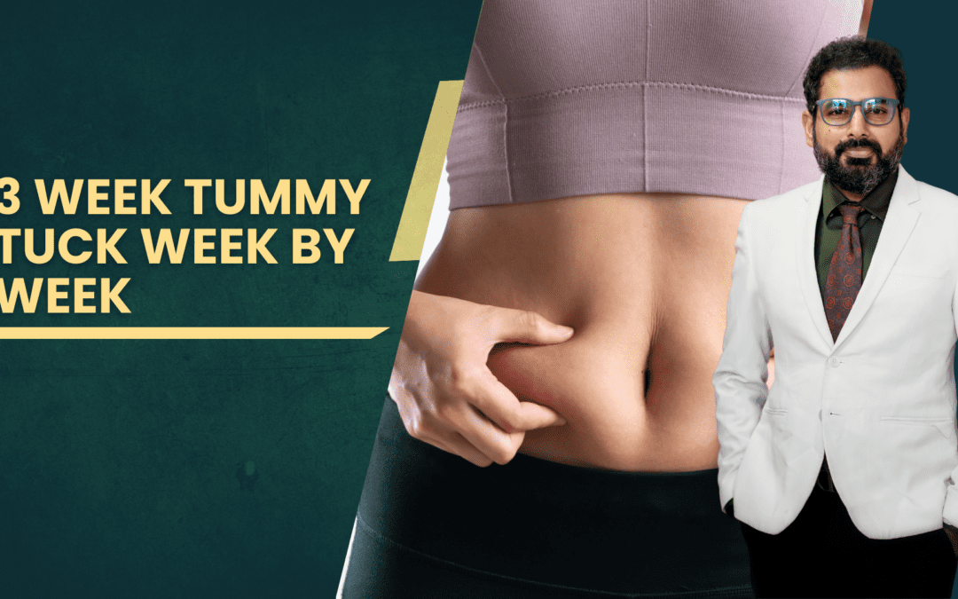 3 week tummy tuck week by week