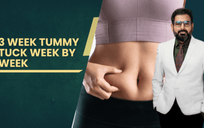 3 Week Tummy Tuck Week by Week Recovery