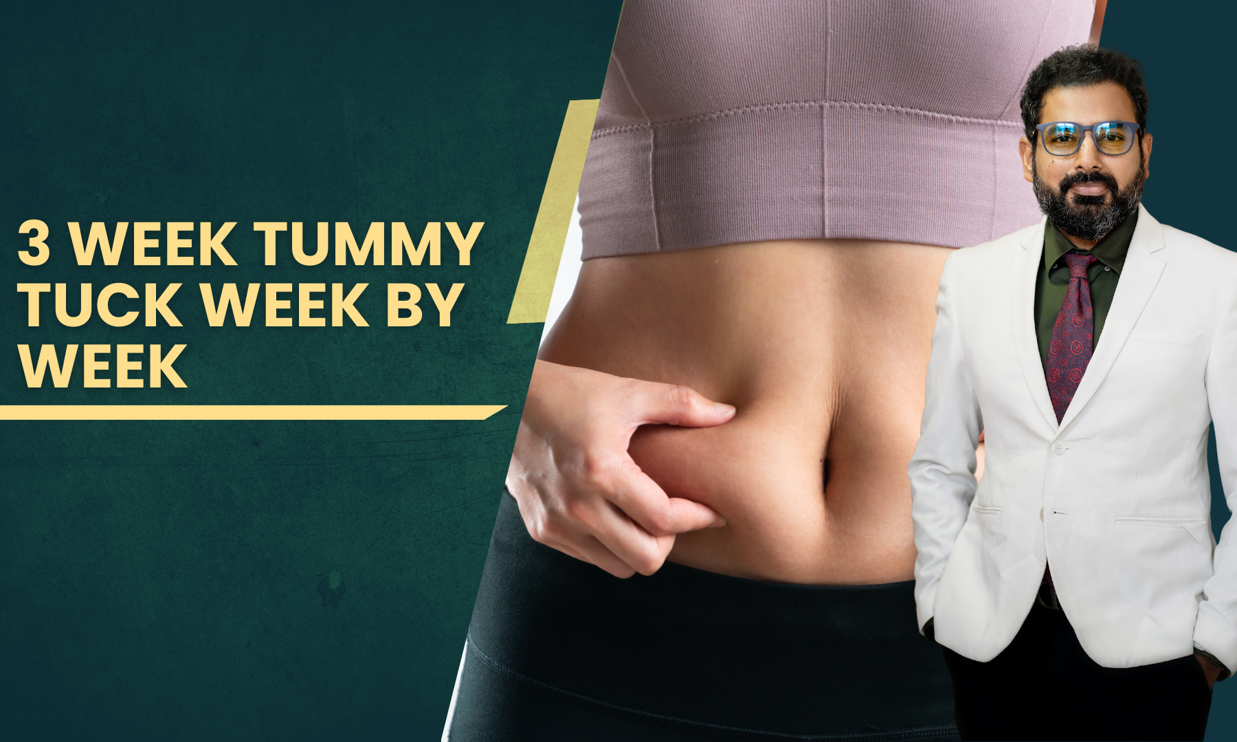 3 week tummy tuck week by week