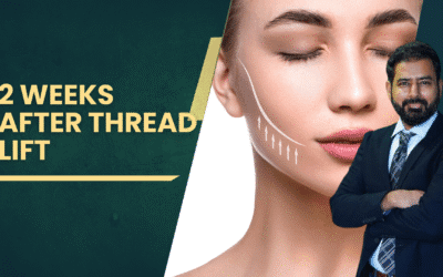 2 Weeks After Thread Lift