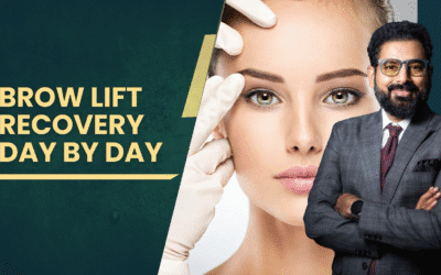 Brow Lift Recovery Day by Day