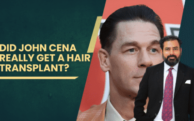 Did John Cena Really Get a Hair Transplant?