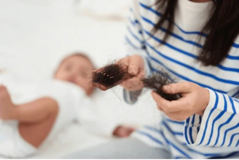 Postpartum Hair Loss After 1 Year Postpartum Hair Loss After 1 Year