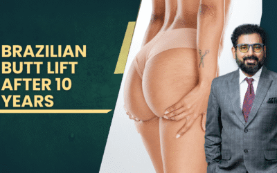 Brazilian Butt Lift After 10 Years