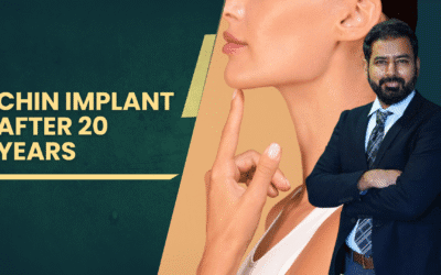 Chin Implant After 20 Years