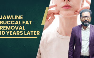 Jawline Buccal Fat Removal 10 Years Later