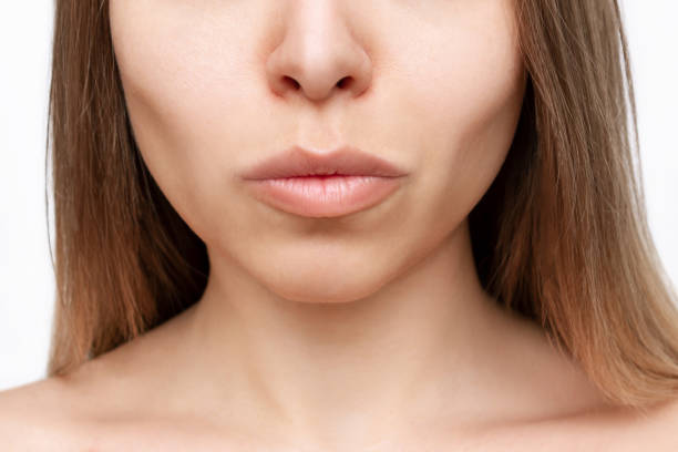 Ageing After Buccal Fat Removal