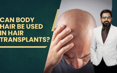 Can Body Hair Be Used in Hair Transplants?