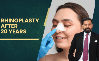 Rhinoplasty After 20 Years: What to Expect & When to Consider Revision