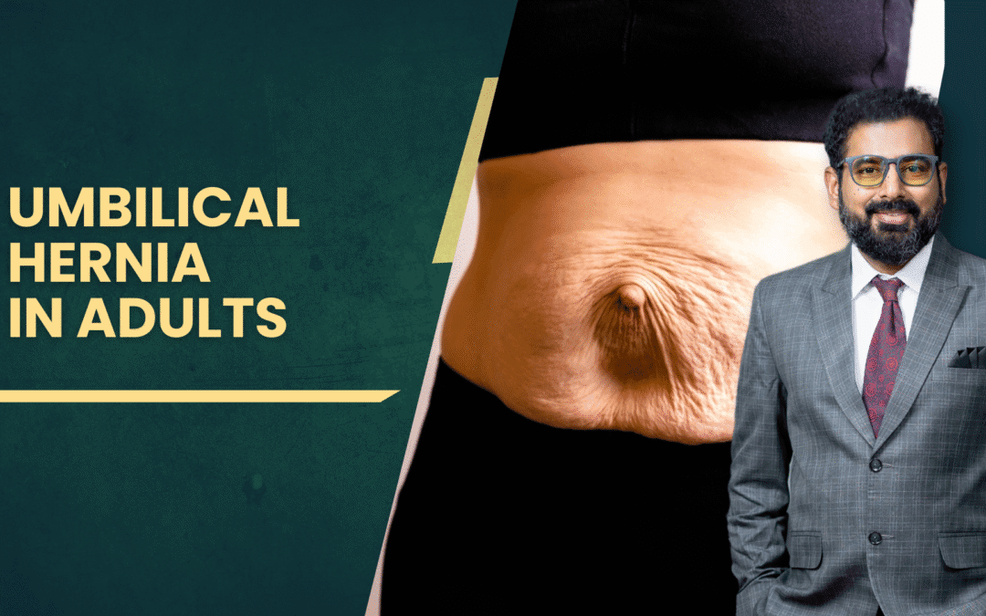 Umbilical Hernia in Adults