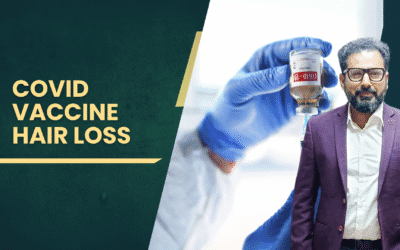 COVID Vaccine Hair Loss