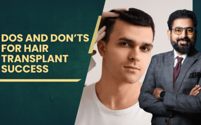 Dos and Don’ts for Hair Transplant Success