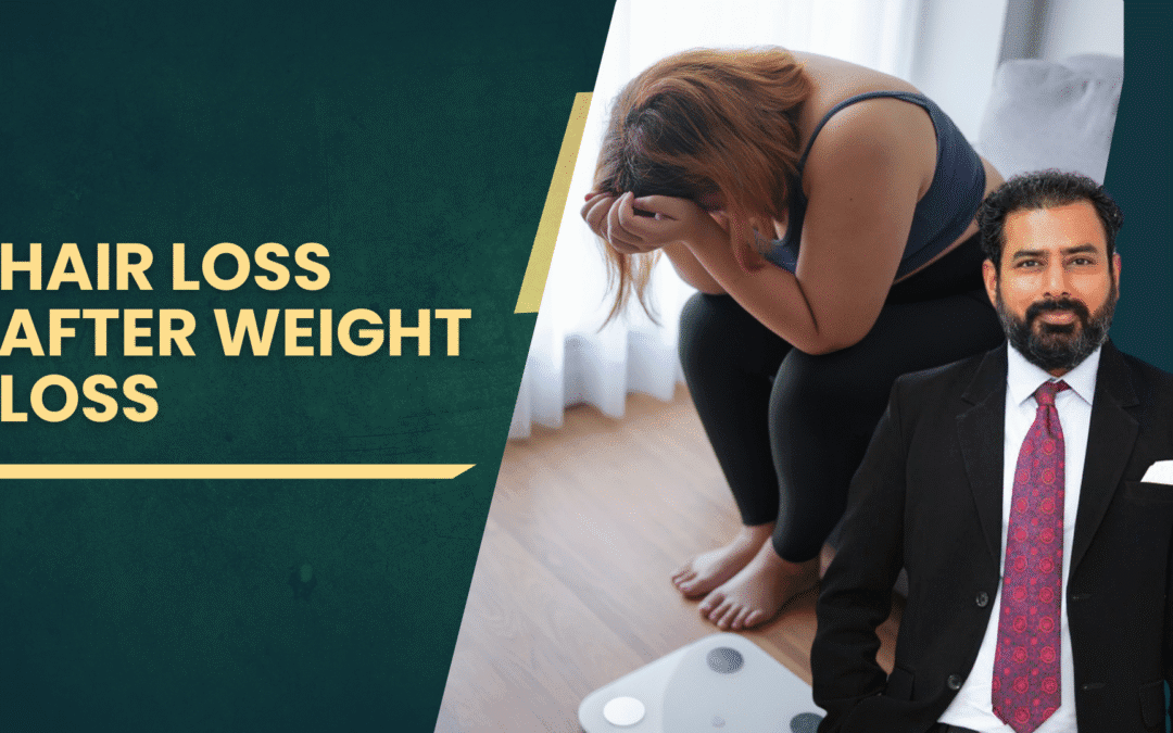 Hair Loss After Weight Loss
