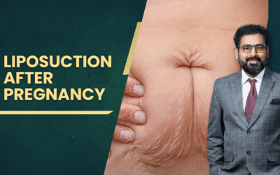Liposuction After Pregnancy
