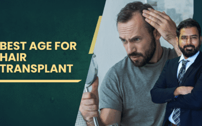 Best Age for Hair Transplant