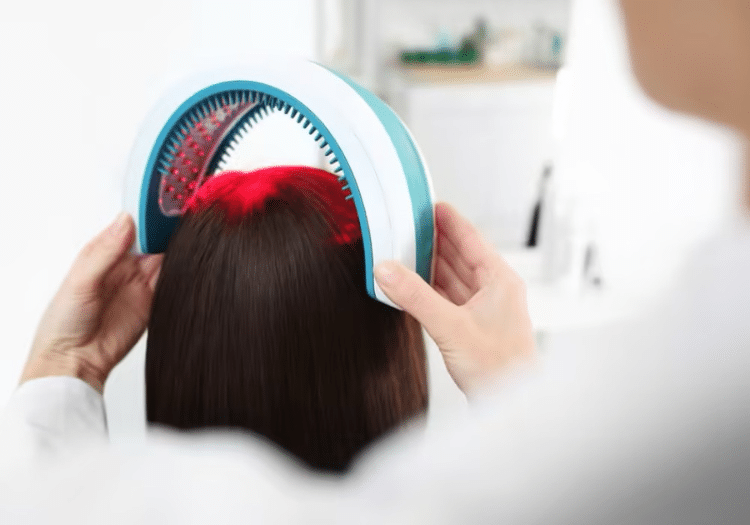 Laser therapy for hair loss in Hyderabad