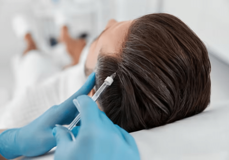 Mesotherapy in Hyderabad