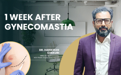 1 Week After Gynecomastia
