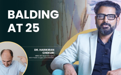 Balding at 25