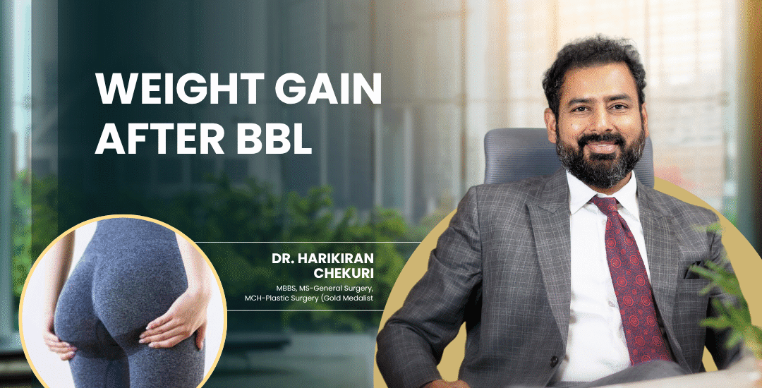 Weight Gain After BBL