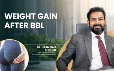 Weight Gain After BBL