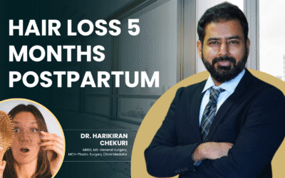 Hair Loss 5 Months Postpartum