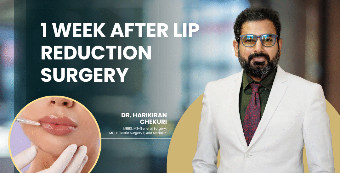 1 Week After Lip Reduction Surgery