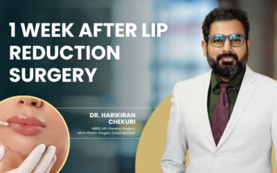 1 Week After Lip Reduction Surgery