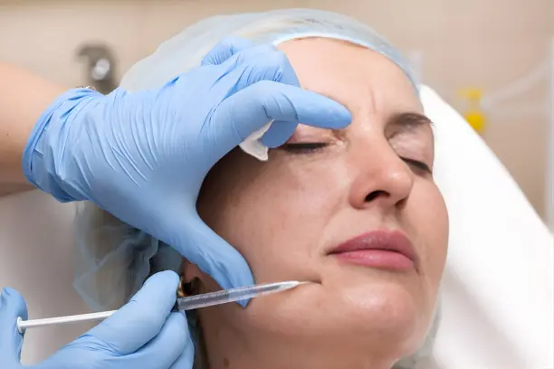 Dermal Fillers in Hyderabad