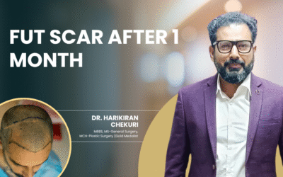 FUT Scar After 1 Month