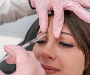 Botox Treatment in Hyderabad