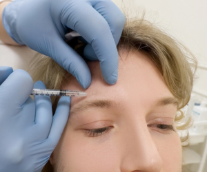 Botox Treatment in Hyderabad