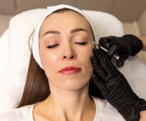 Botox Treatment in Hyderabad