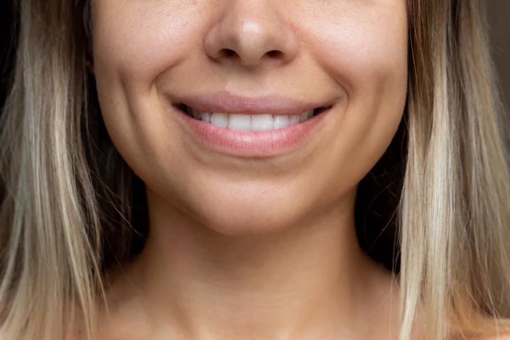 Bilateral Cheek Dimples | Redefine Types of Dimples