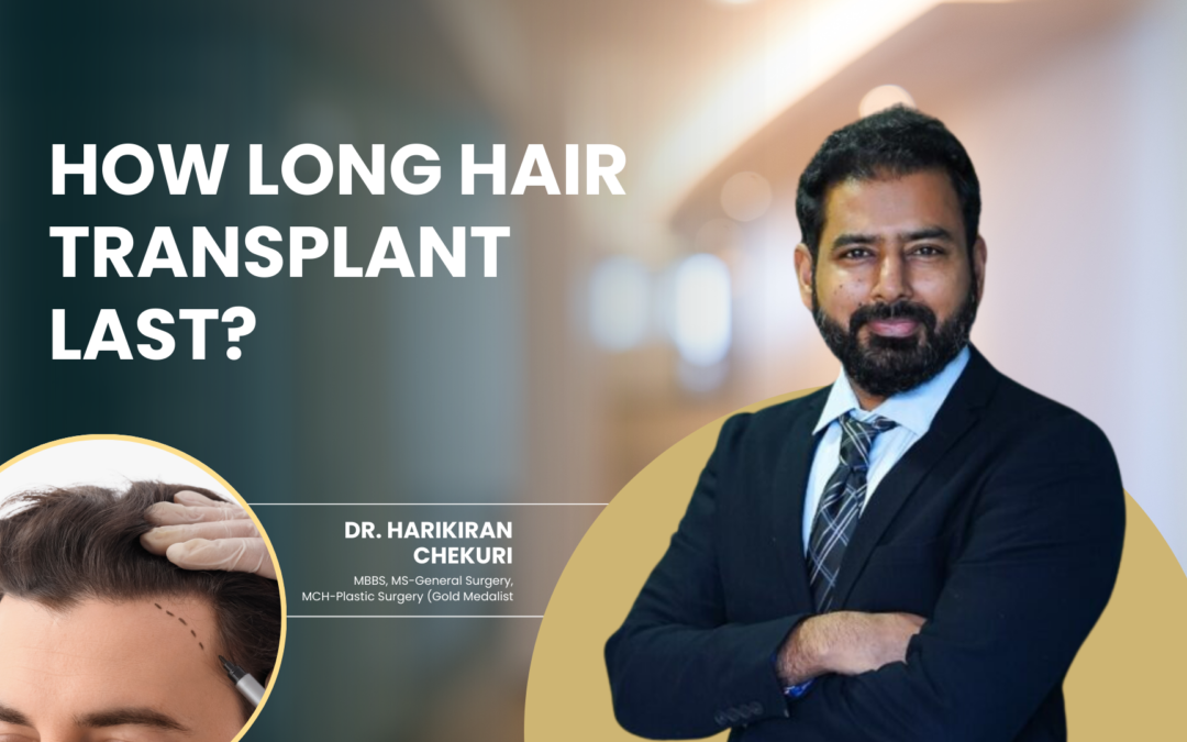 How Long Hair Transplant Last ?