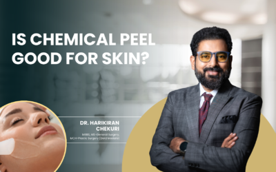 Is Chemical Peel Good for Skin?
